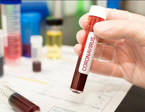 Koronavirus: Co je to koronavirus? Mapa nakažených v ČR i dle krajů